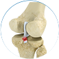 pcl reconstruction by Dr. McCarthy